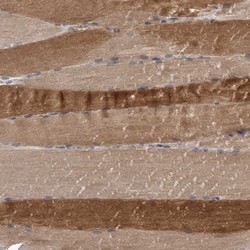 Cullin-7 Antibody, Novus Biologicals 0.1mL; Unlabeled:Antibodies, Polyclonal